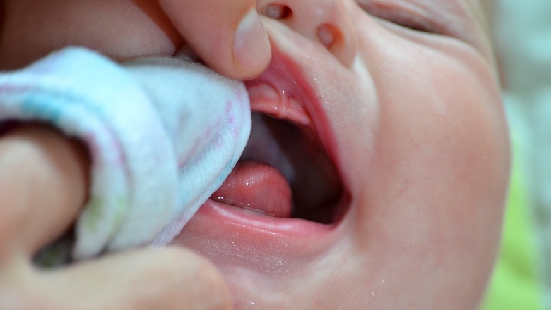 Bebeklerde Ağız ve Diş Sağlığı